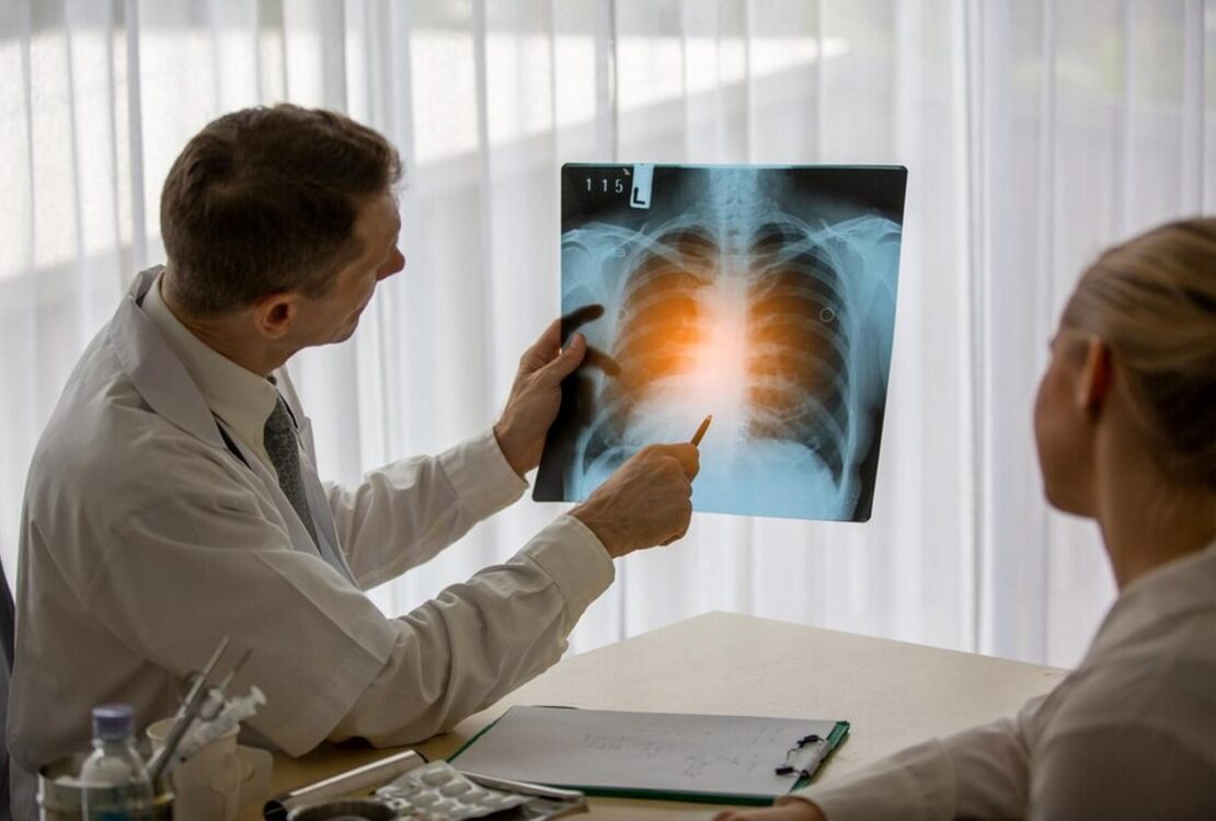 lekarz pulmonolog